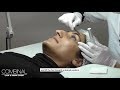 BROW LIFTING & FIXING LOSJON BROW LIFTING & FIXING LOSJON